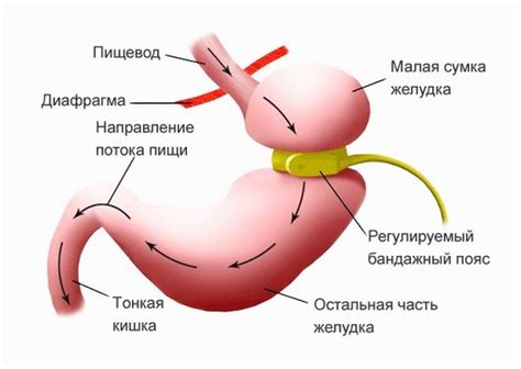 Операция на желудок для похудения что нужно знать